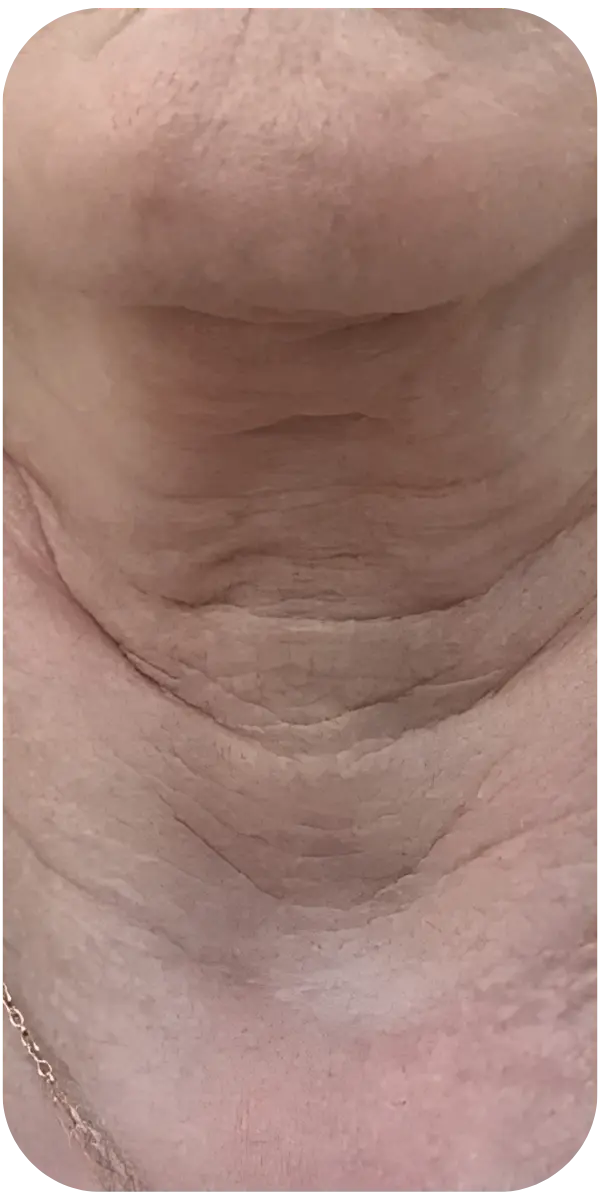 قبل