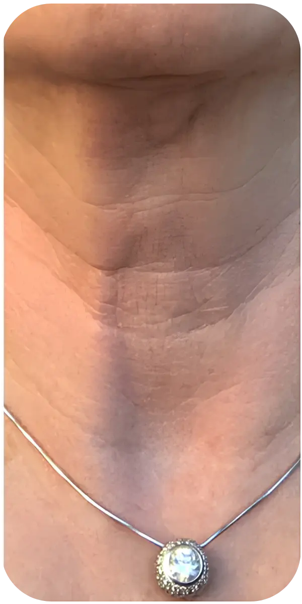 بعد 4 أسابيع