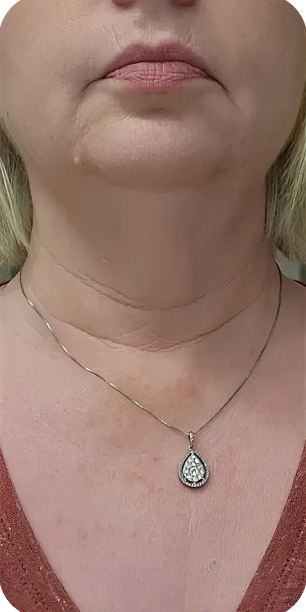 قبل